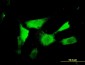 ASAHL Antibody (monoclonal) (M01)